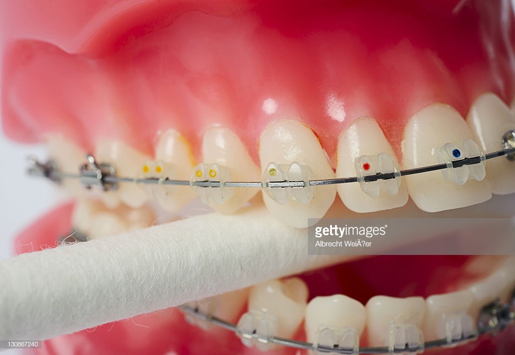 Balanced Occlusion In Complete Dentures Murphy OR 97533